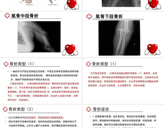 红色骨折上肢骨折护理查房