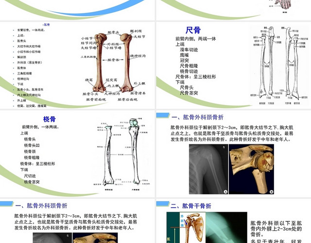 绿色简约风上肢骨折及肱骨干骨折内固定手术配合PPT模板