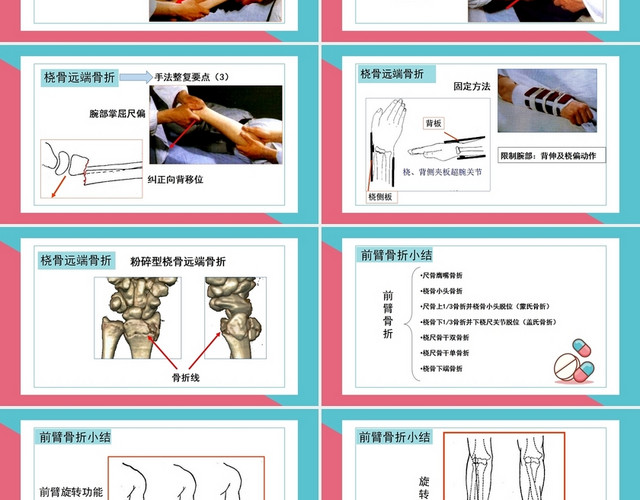 粉色骨折上肢骨折护理查房