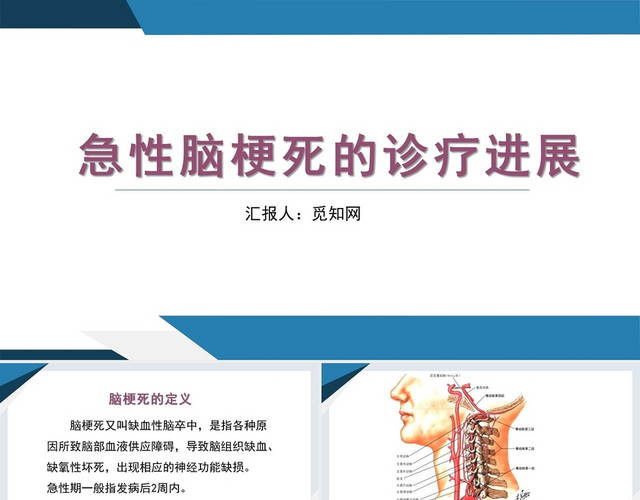 蓝色急性脑梗死的诊疗进展脑梗死护理查房PPT