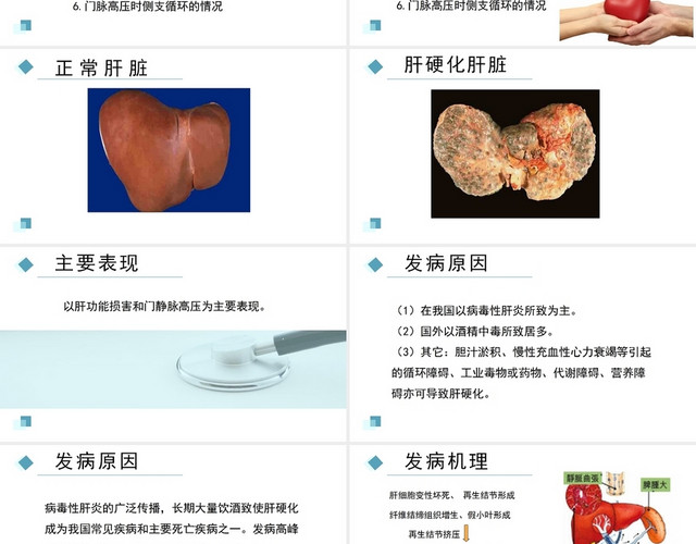 蓝色简约风肝硬化腹水病人的护理PPT模板