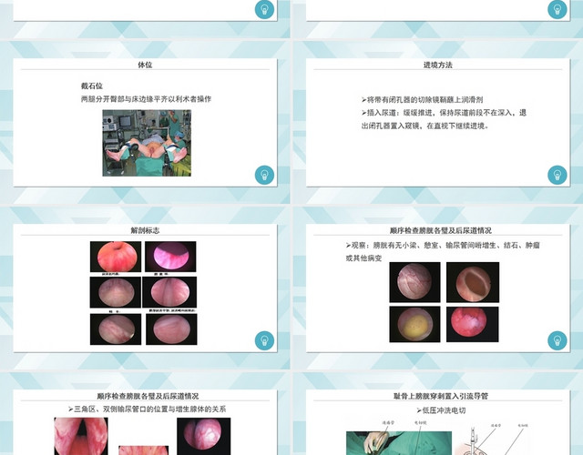 蓝色简约风经尿道前列腺电切术医疗护理PPT模板