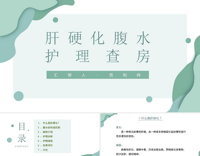 绿色肝硬化腹水患者护理查房肝硬化患者护理查房