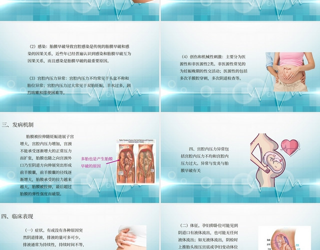蓝色胎膜早破护理查房