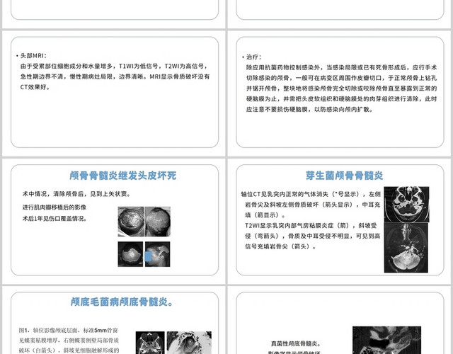 白色颅脑损伤的并发症及后遗症颅脑损伤护理查房