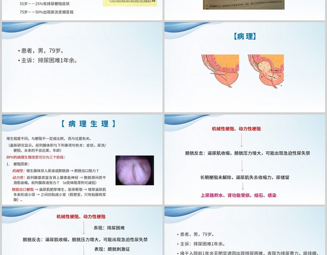 蓝色护理查房良性前列腺增生护理查房前列腺增生