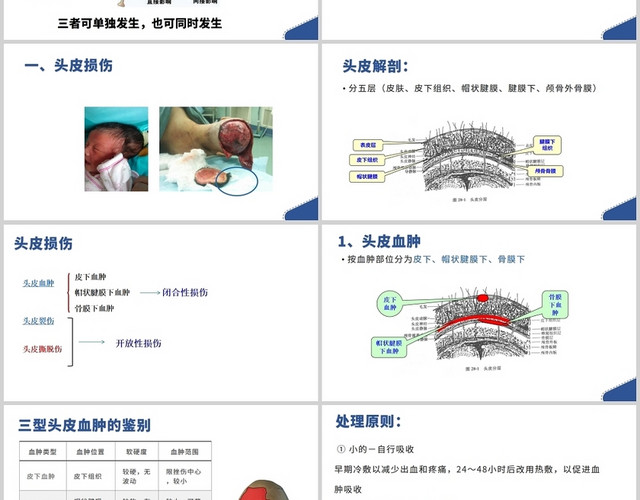 蓝色颅脑损伤病人的护理颅脑损伤护理查房