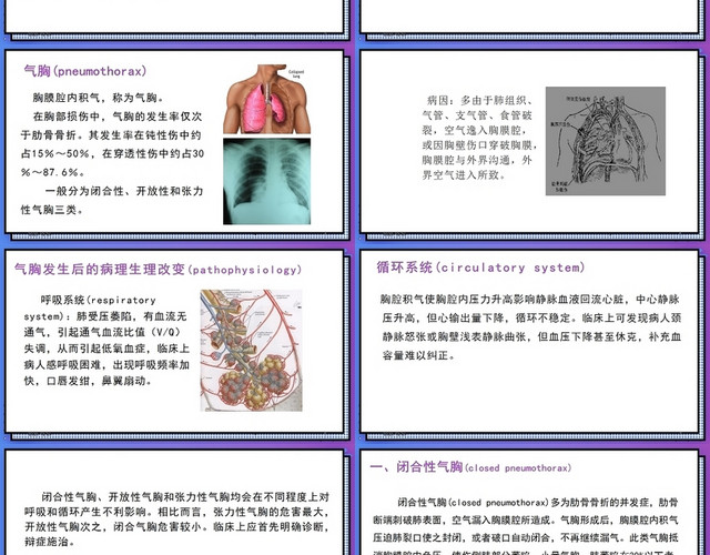 紫色气胸的护理查房护理查房气胸患者