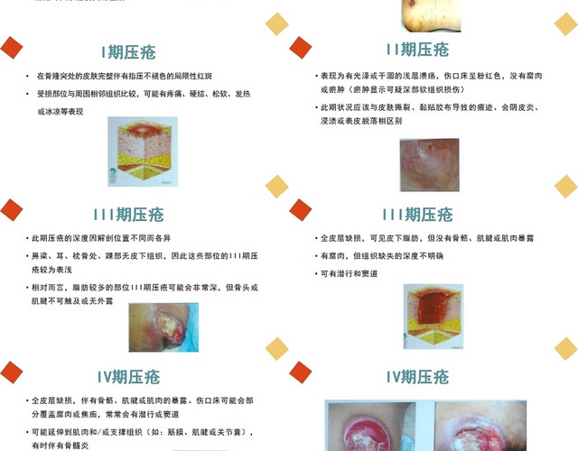 橙色失禁性皮炎与压疮关系压疮的预防及护理PPT