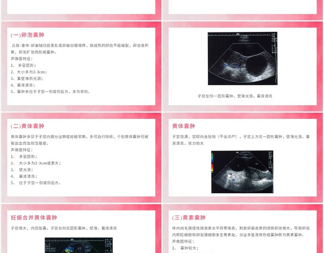 粉色小清风卵巢癌护理查房卵巢疾病的超声诊断PPT模板