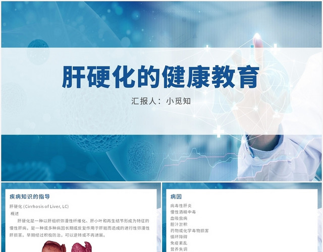 蓝色商务风肝硬化患者护理查房肝硬化的健康教育PPT模板