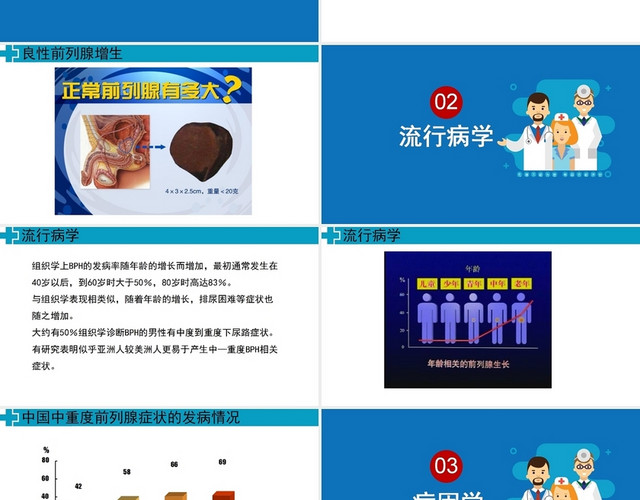蓝色前列腺增生的基础知识护理查房前列腺增生