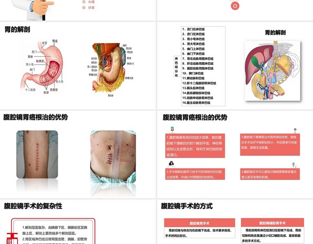 红黑医疗机构医院医学教育胃癌护理查房医学院校PPT教学课