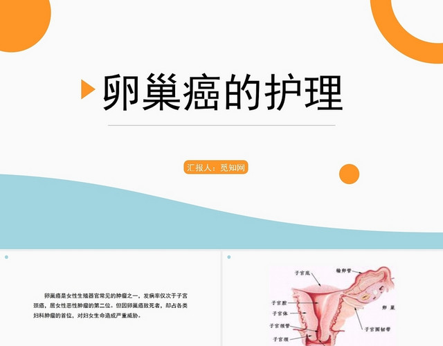 橙色简约风卵巢癌护理查房PPT模板