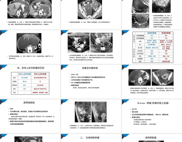 蓝色商务风卵巢癌护理查房PPT模板