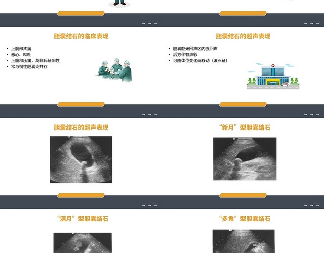 黄色简约风胆囊结石的超声诊断PPT模板