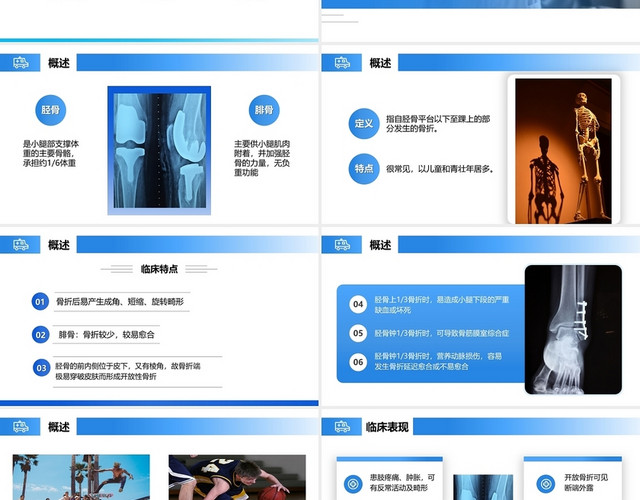 蓝色骨折的护理PPT模板
