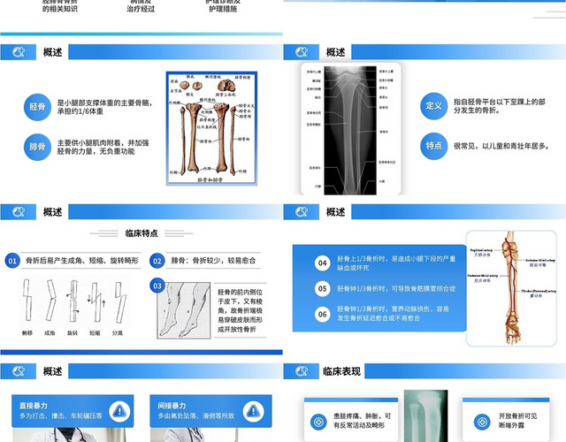 简约胫腓骨骨折护理查房PPT模板