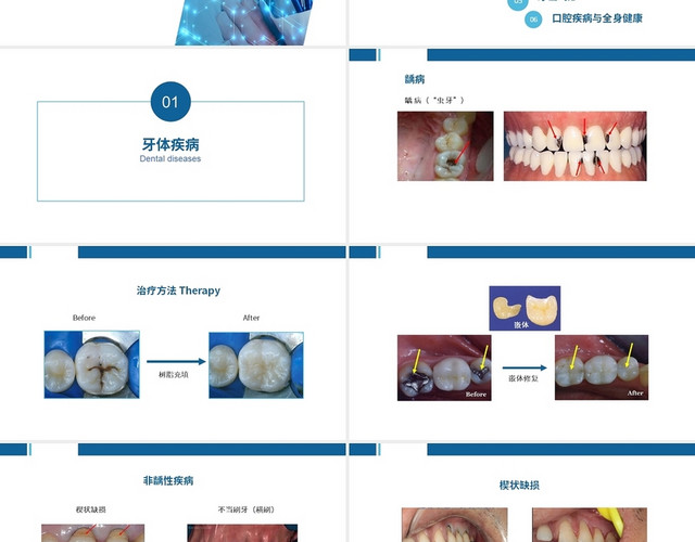 蓝色系简约风格口腔宣教培训PPT模板