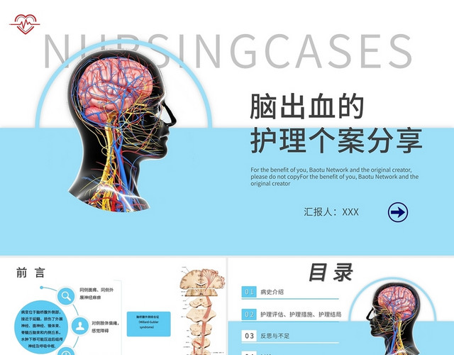 蓝色简约脑出血个案分析PPT模板