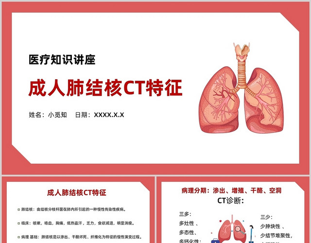 红色简约风成人肺结核CT特征医疗知识讲座PPT模板