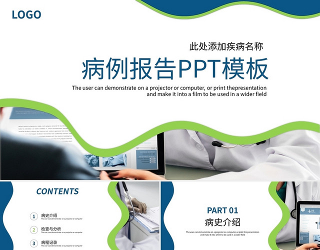 蓝绿简约病例报告PPT模板