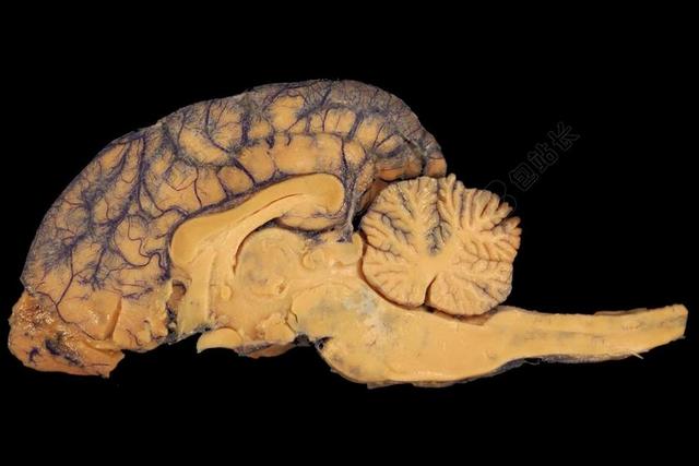 脑解剖学生物学背景图片