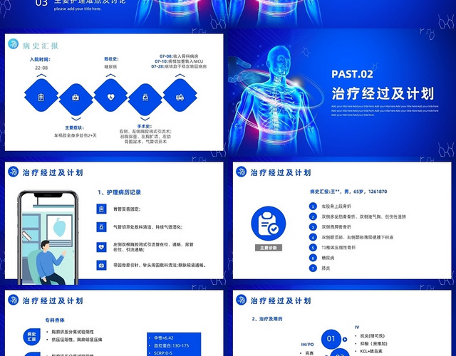 蓝色简约风骨科疑难病例讨论培训PPT