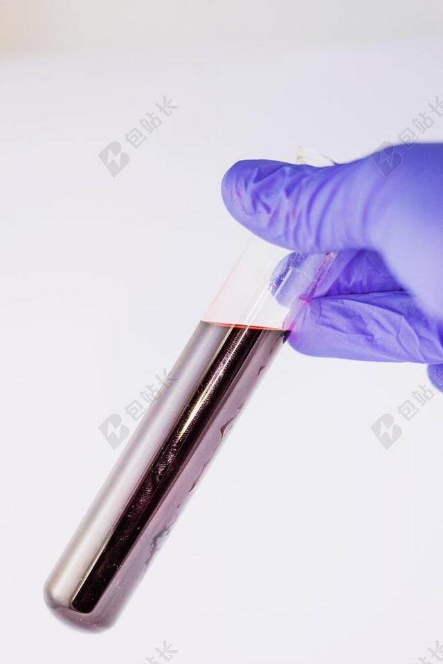 红色医学特写试管中的血背景图片