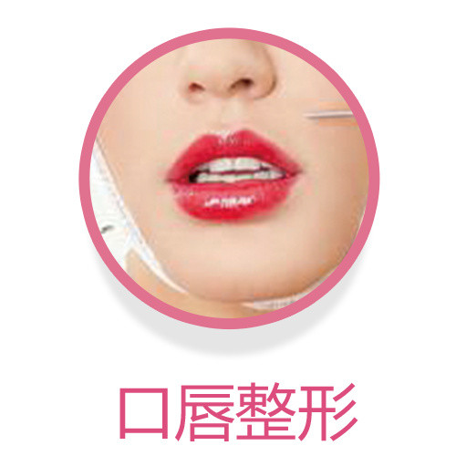 口唇整形实物展示图