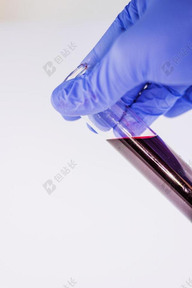 血 医疗 尝试 管 诊断程序 实验室 手套 橡胶 医院
