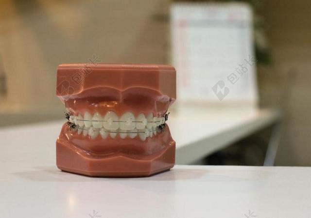桌子上的牙齿模型背景图片