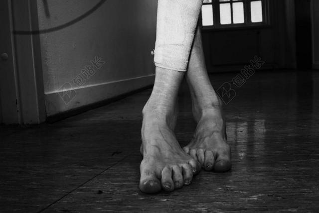 脚 腿 女子 人类 伤疤 抑郁 自我伤害