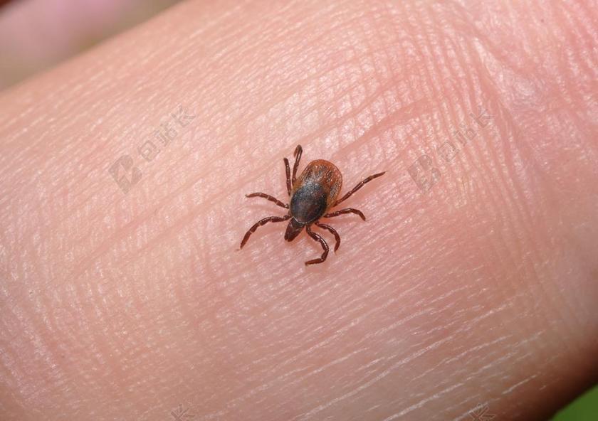 草虱 虱子 寄生虫 吸血